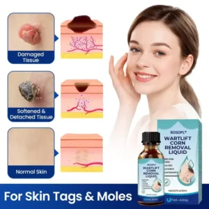 ROSOPL® WartLift Wart Removal Fluid 12 ROSOPL® WartLift Wart Removal Fluid